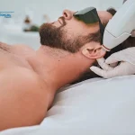 تعمیر دستگاه لیزر موهای زائد در مشهد