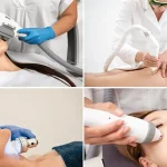 آموزش لیزر در مشهد